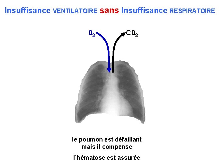 Insuffisance VENTILATOIRE sans Insuffisance RESPIRATOIRE 02 C 02 le poumon est défaillant mais il