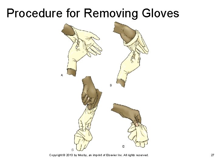 Procedure for Removing Gloves Copyright © 2013 by Mosby, an imprint of Elsevier Inc.