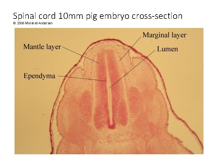 Spinal cord 10 mm pig embryo cross-section © 2006 Marshall Andersen 