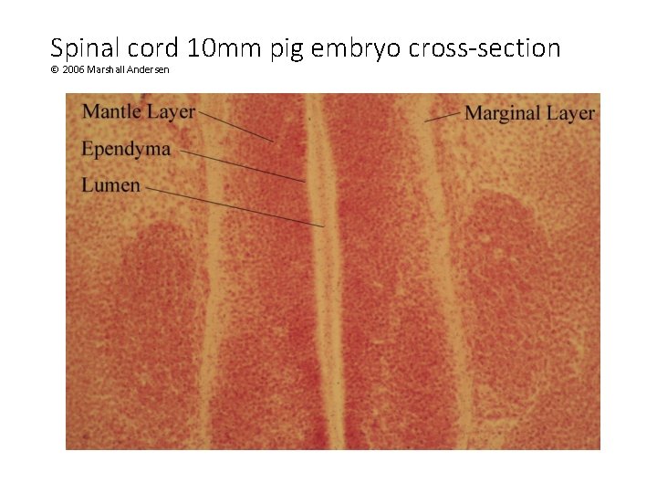 Spinal cord 10 mm pig embryo cross-section © 2006 Marshall Andersen 