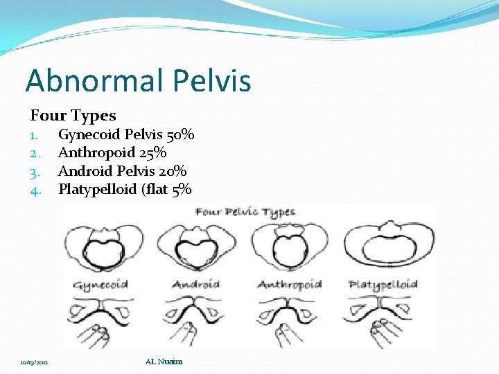 Abnormal Pelvis Four Types 1. 2. 3. 4. 10/19/2021 Gynecoid Pelvis 50% Anthropoid 25%