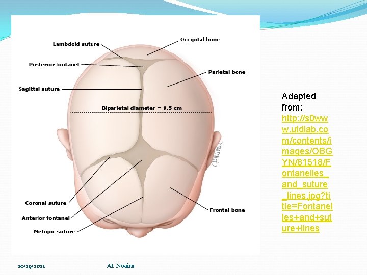 Adapted from: http: //s 0 ww w. utdlab. co m/contents/i mages/OBG YN/81518/F ontanelles_ and_suture