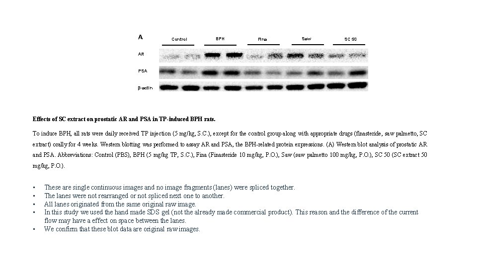 A Control BPH Fina Saw SC 50 AR PSA β-actin Effects of SC extract