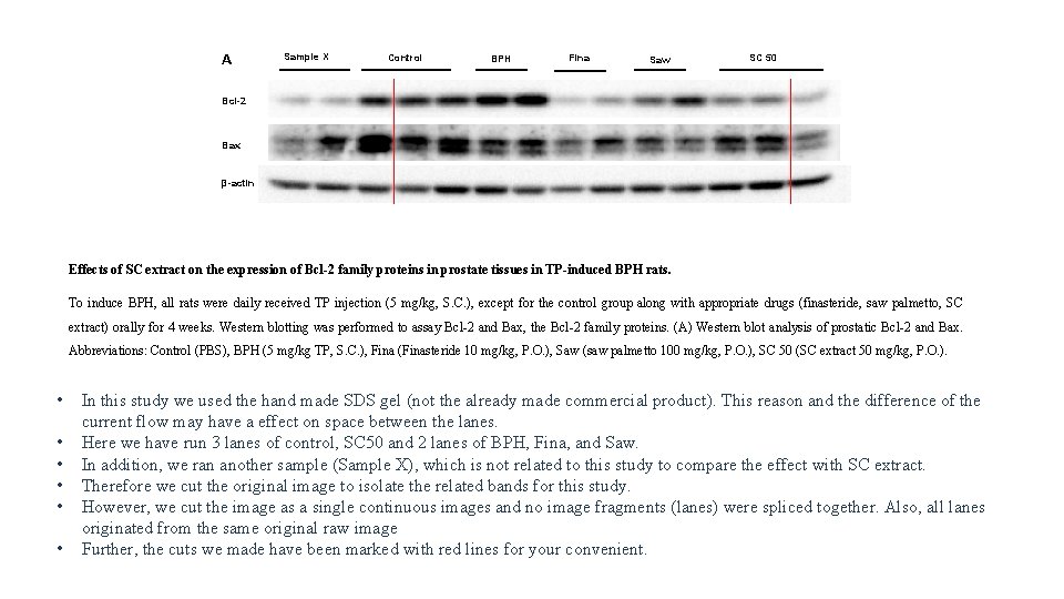 A Sample X Control BPH Fina Saw SC 50 Bcl-2 Bax β-actin Effects of