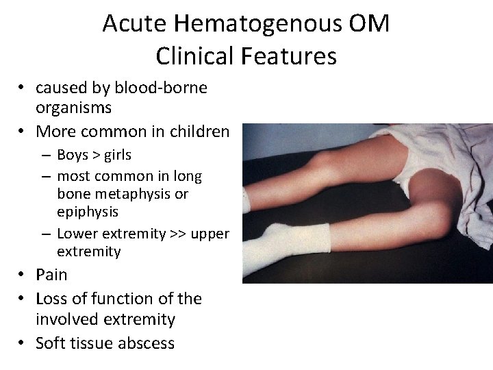 Acute Hematogenous OM Clinical Features • caused by blood-borne organisms • More common in
