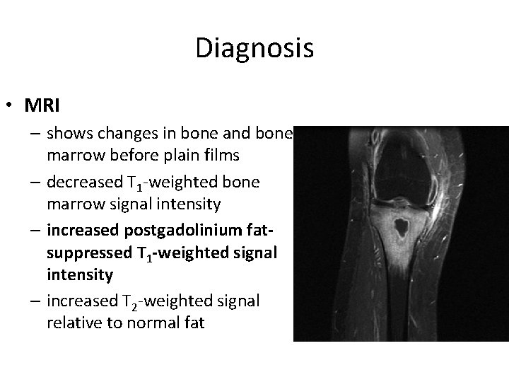 Diagnosis • MRI – shows changes in bone and bone marrow before plain films