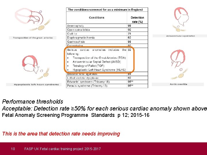 Performance thresholds Acceptable: Detection rate ≥ 50% for each serious cardiac anomaly shown above