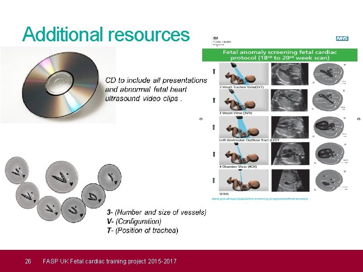 Additional resources 26 FASP UK Fetal cardiac training project 2015 -2017 