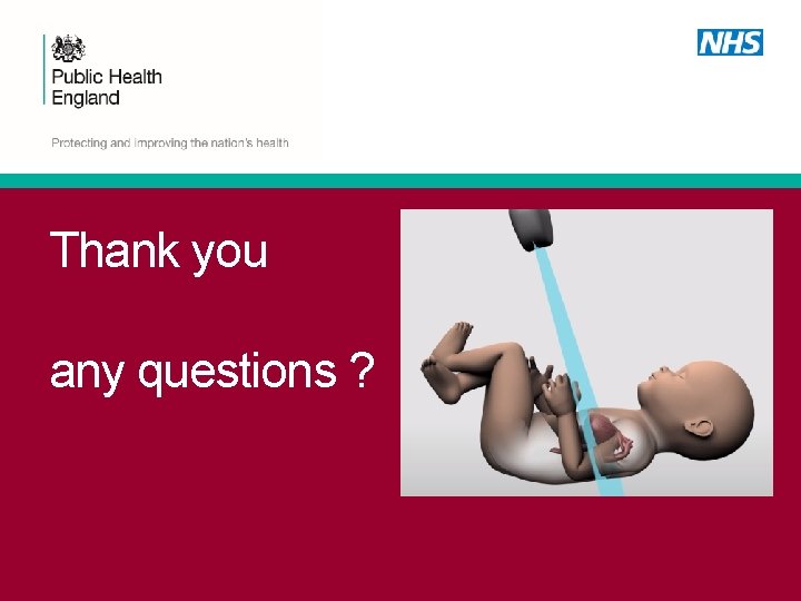 Thank you any questions ? 