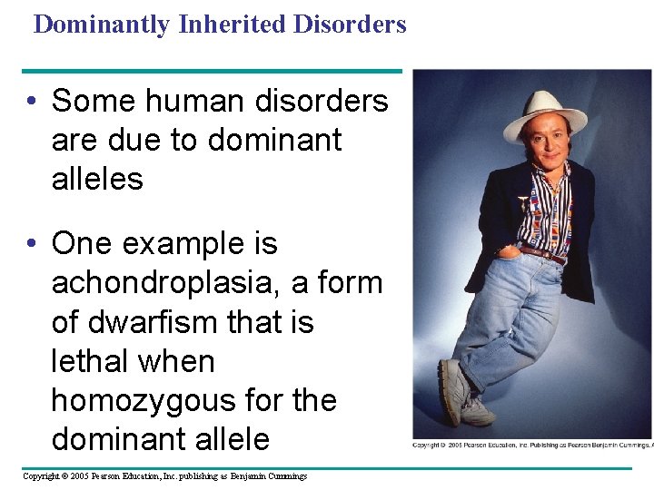 Dominantly Inherited Disorders • Some human disorders are due to dominant alleles • One