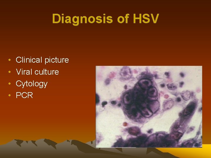 Diagnosis of HSV • • Clinical picture Viral culture Cytology PCR 