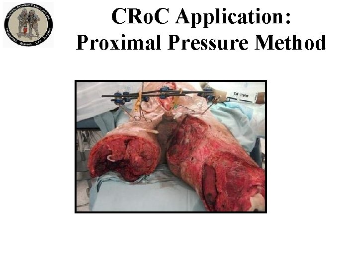 CRo. C Application: Proximal Pressure Method 