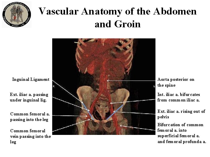 Vascular Anatomy of the Abdomen and Groin Inguinal Ligament Ext. iliac a. passing under