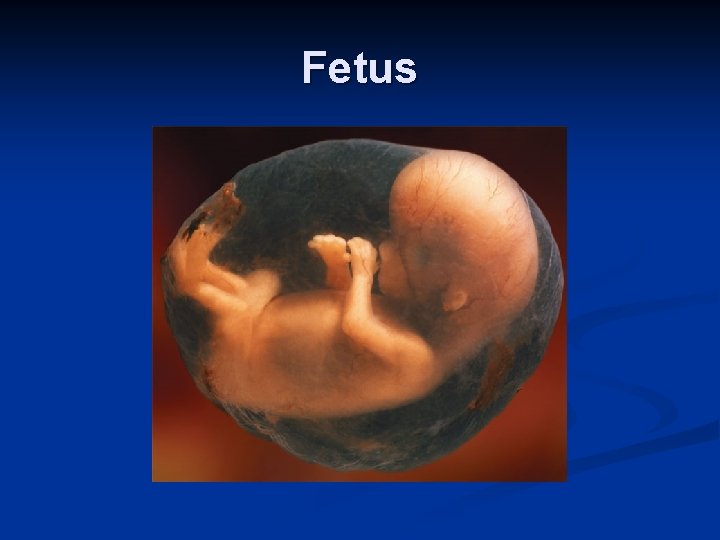 Fetus 