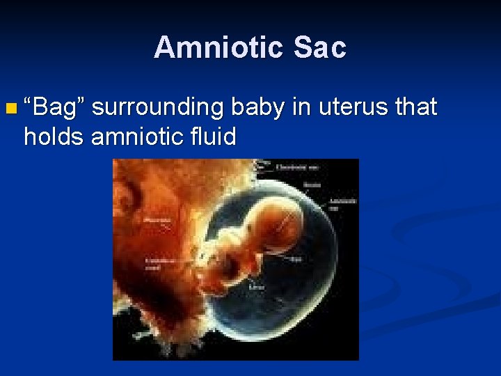 Amniotic Sac n “Bag” surrounding baby in uterus that holds amniotic fluid 