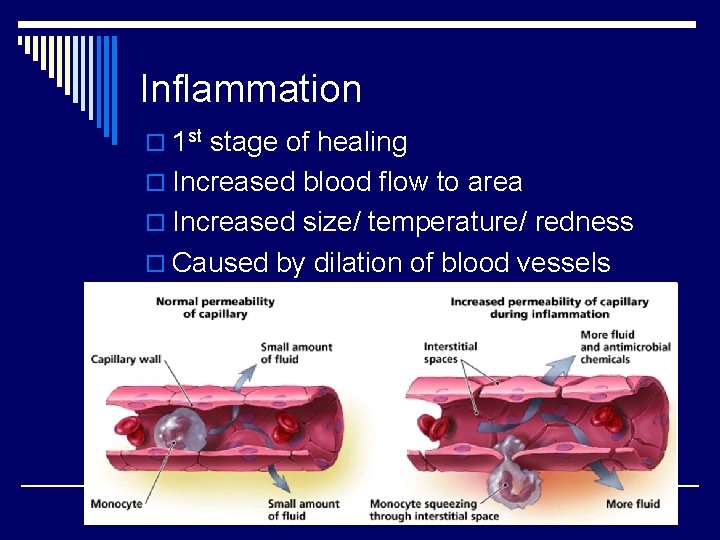 Inflammation o 1 st stage of healing o Increased blood flow to area o