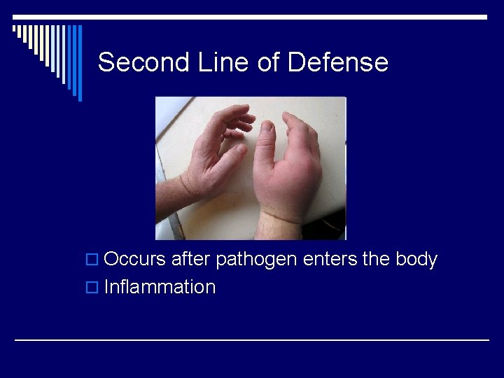 Second Line of Defense o Occurs after pathogen enters the body o Inflammation 