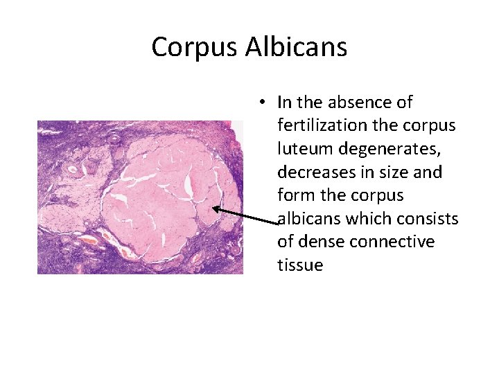 Corpus Albicans • In the absence of fertilization the corpus luteum degenerates, decreases in
