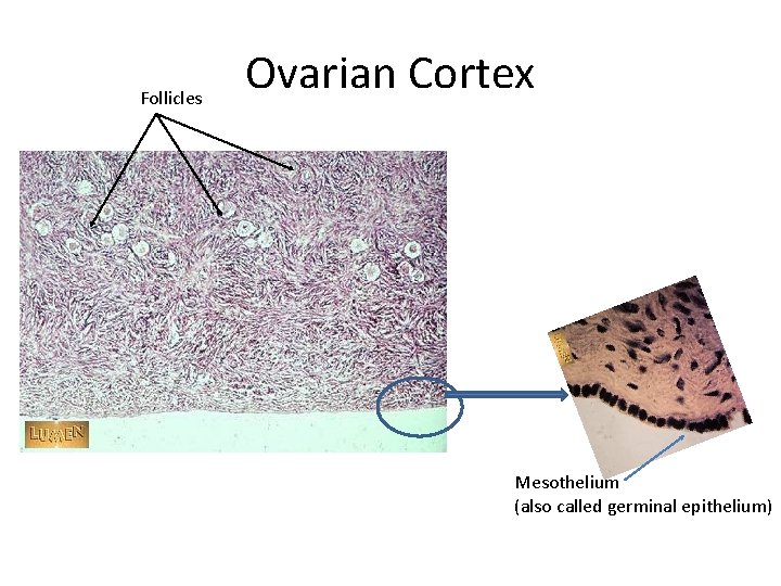 Follicles Ovarian Cortex Mesothelium (also called germinal epithelium) 