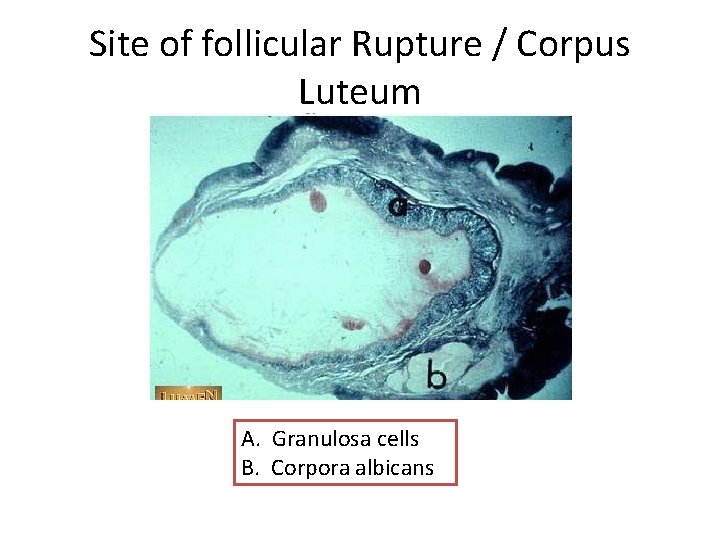 Site of follicular Rupture / Corpus Luteum A. Granulosa cells B. Corpora albicans 