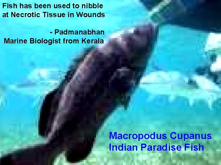 Fish has been used to nibble at Necrotic Tissue in Wounds - Padmanabhan Marine