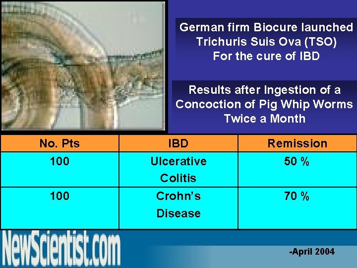 German firm Biocure launched Trichuris Suis Ova (TSO) For the cure of IBD Results