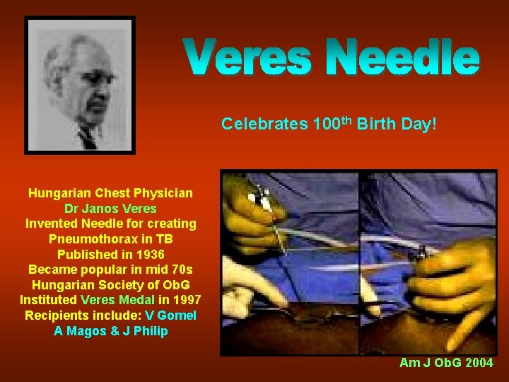 Celebrates 100 th Birth Day! Hungarian Chest Physician Dr Janos Veres Invented Needle for