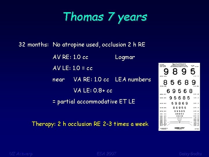 Thomas 7 years 32 months: No atropine used, occlusion 2 h RE AV RE: