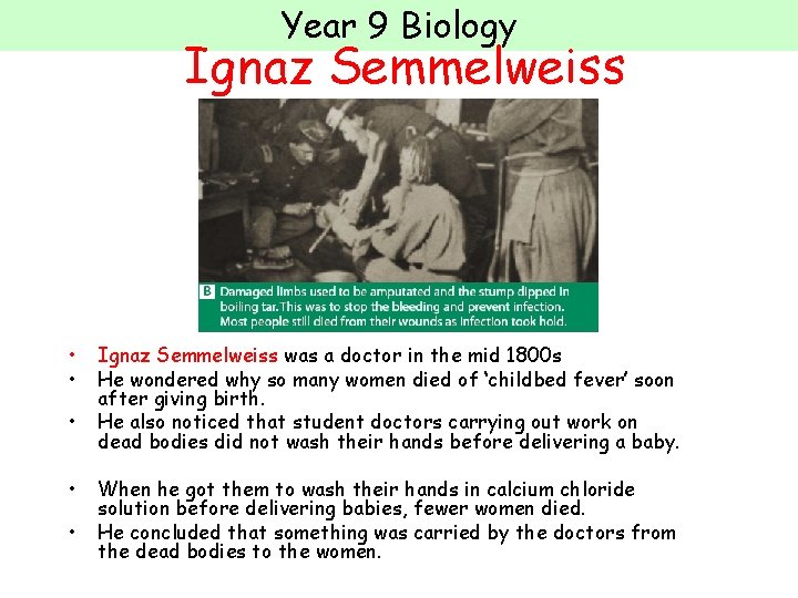 Year 9 Biology Ignaz Semmelweiss • • • Ignaz Semmelweiss was a doctor in
