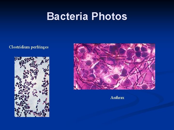 Bacteria Photos Clostridium perfringes Anthrax 
