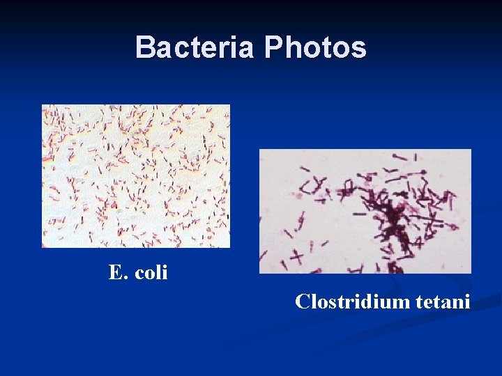 Bacteria Photos E. coli Clostridium tetani 