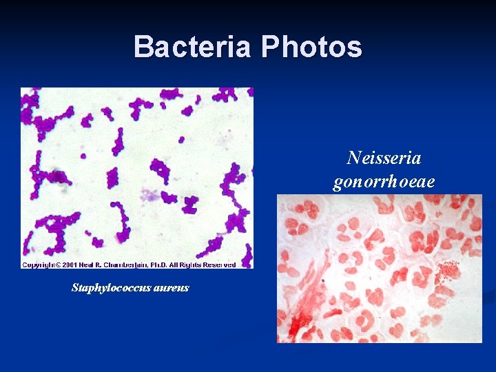 Bacteria Photos Neisseria gonorrhoeae Staphylococcus aureus 