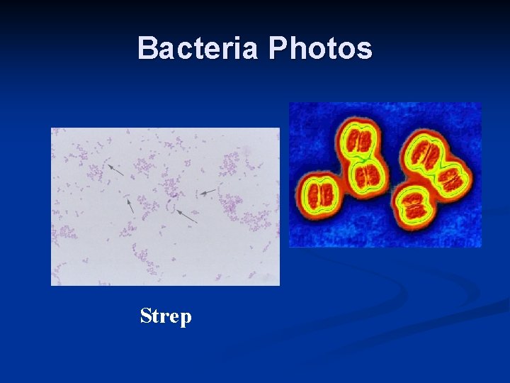 Bacteria Photos Strep 