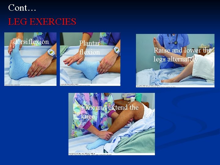 Cont… LEG EXERCIES dorsiflexion Plantar flexion Flex and extend the knee Raise and lower