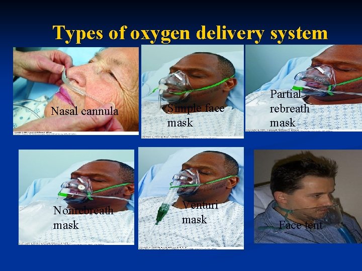 Types of oxygen delivery system Nasal cannula Nonrebreath mask Simple face mask Venturi mask