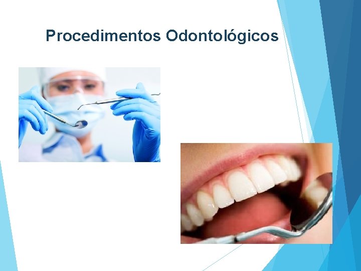 Procedimentos Odontológicos 