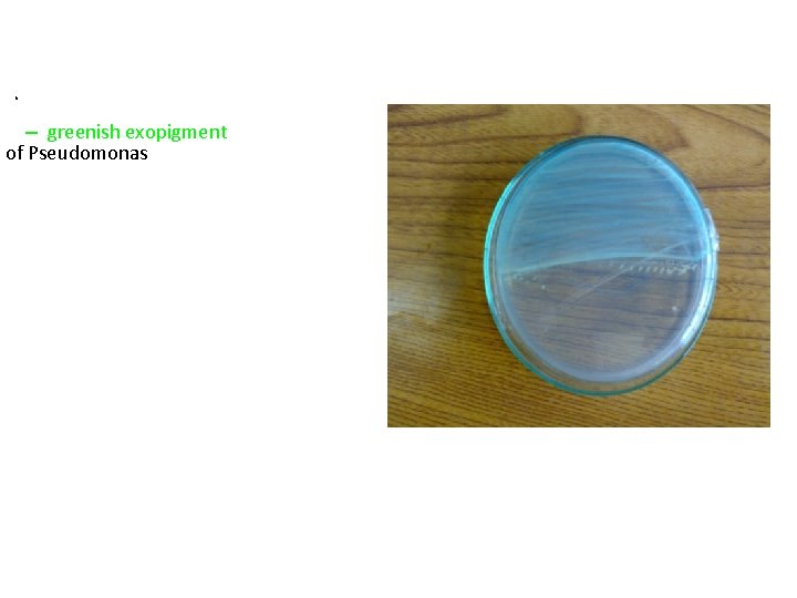 b- – greenish exopigment of Pseudomonas 