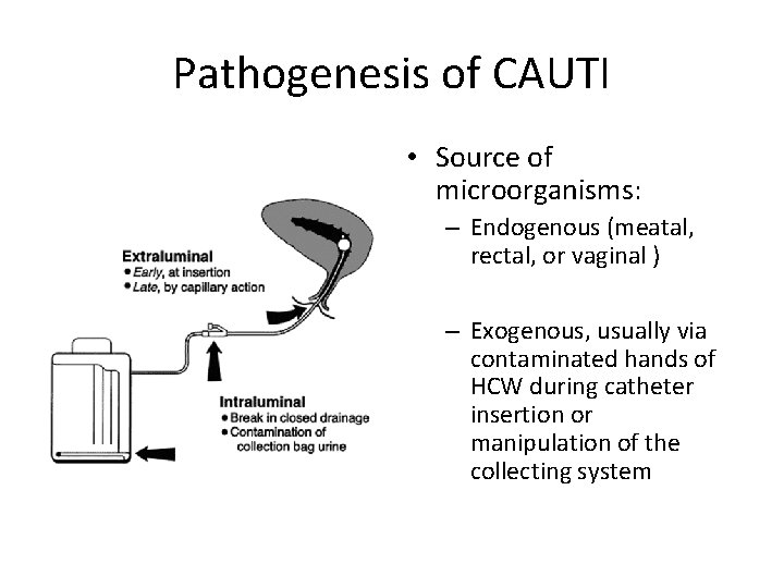 Pathogenesis of CAUTI • Source of microorganisms: – Endogenous (meatal, rectal, or vaginal )