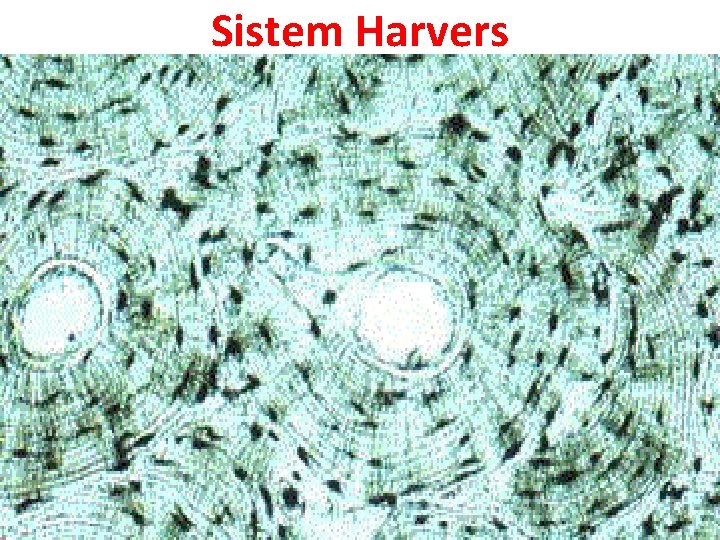 Sistem Harvers 