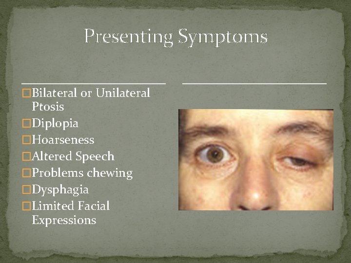 Presenting Symptoms �Bilateral or Unilateral Ptosis �Diplopia �Hoarseness �Altered Speech �Problems chewing �Dysphagia �Limited