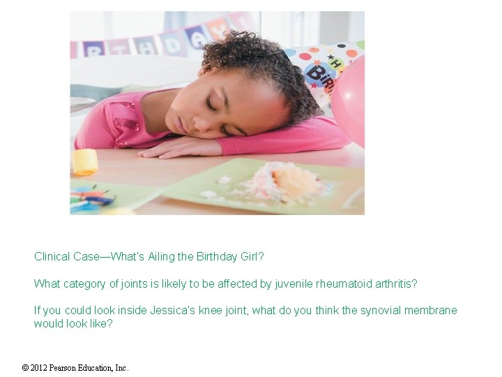 Clinical Case—What’s Ailing the Birthday Girl? What category of joints is likely to be