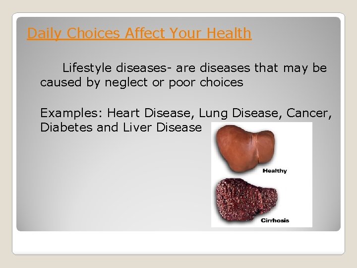 Daily Choices Affect Your Health Lifestyle diseases- are diseases that may be caused by
