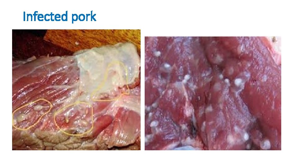 Infected pork Infected pork