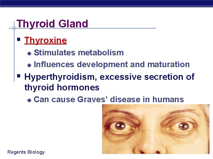 Thyroid Gland § Thyroxine Stimulates metabolism u Influences development and maturation u § Hyperthyroidism,