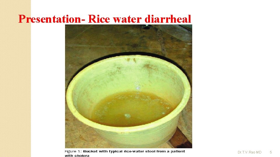 Presentation- Rice water diarrheal Dr. T. V. Rao MD 5 