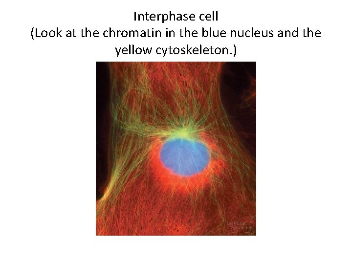 Interphase cell (Look at the chromatin in the blue nucleus and the yellow cytoskeleton.