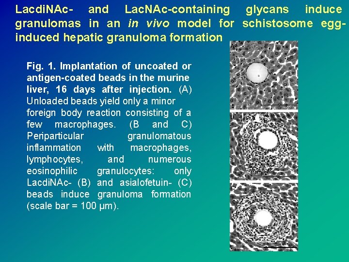 Lacdi. NAc- and Lac. NAc-containing glycans induce granulomas in an in vivo model for