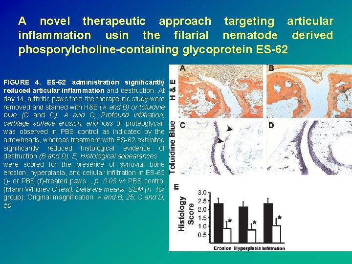 A novel therapeutic approach targeting articular inflammation usin the filarial nematode derived phosporylcholine-containing glycoprotein