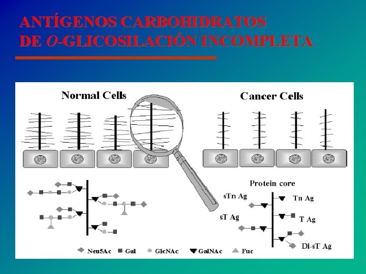 ANTÍGENOS CARBOHIDRATOS DE O-GLICOSILACIÓN INCOMPLETA Gal. NAc Tn Gal. NAc-Gal TF Gal. NAc-Ac. Siálico