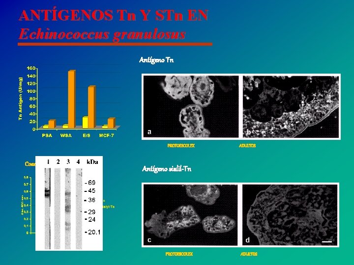 ANTÍGENOS Tn Y STn EN Echinococcus granulosus Antígeno Tn PROTOESCOLEX Coexpresión de s. Tn